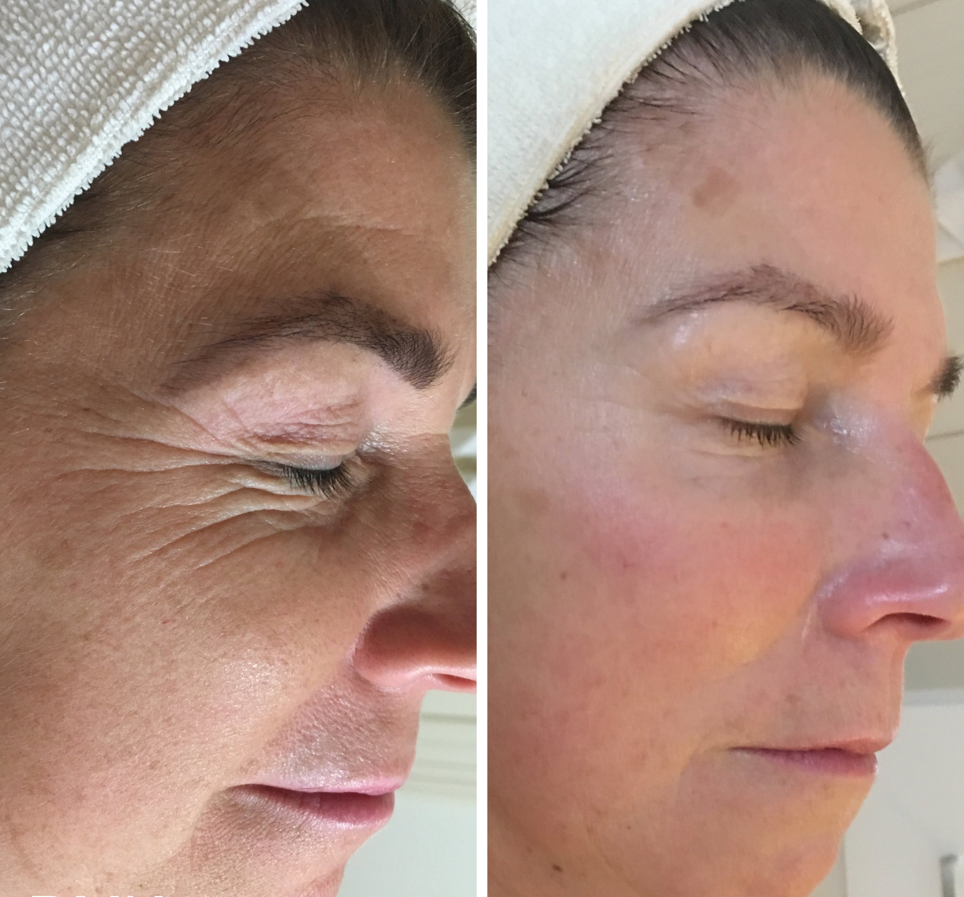 MyDMK_Branded_Before and After Imagery_Ageing_2_300dpi.jpg